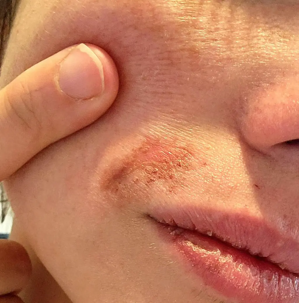 Bezpieczeństwo threadingu – brak substancji chemicznych