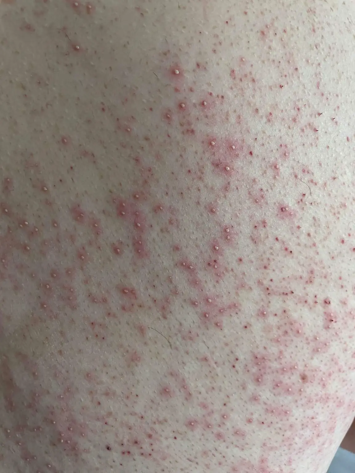 Efekty threadingu – gładka i zdrowa skóra